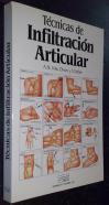 Técnicas de infiltración articular